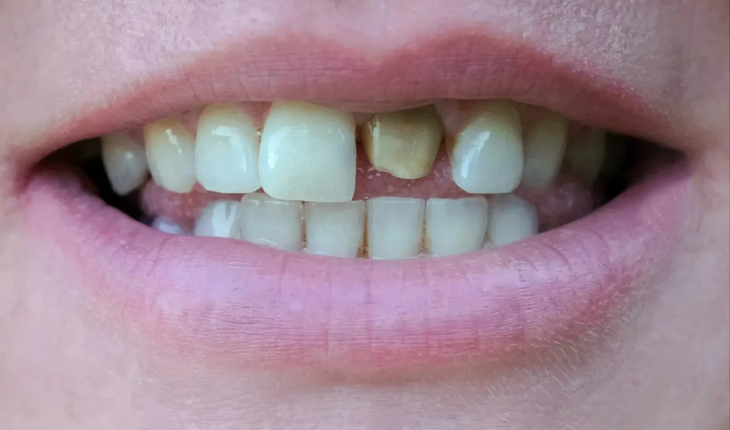 AZ Dental Implants